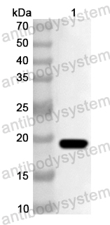 Anti-Human CD302 Polyclonal Antibody