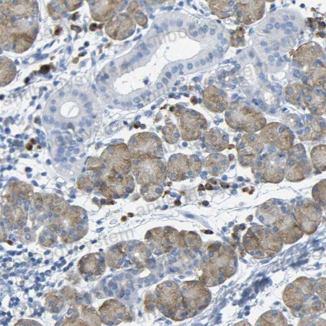 Immunohistochemical for Anti-Human CD307a/FCRL1 Polyclonal Antibody ?>