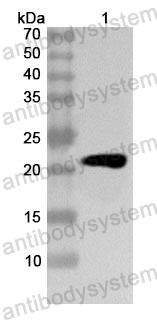 Anti-Human NOX5 Polyclonal Antibody