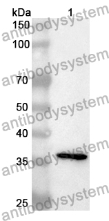 Anti-Human HAUS7 Polyclonal Antibody