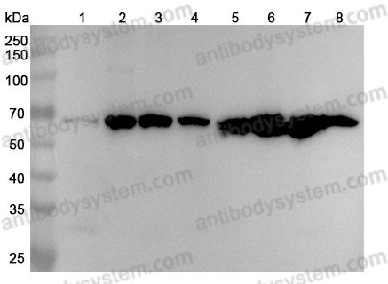 Anti-SLC40A1 Polyclonal Antibody
