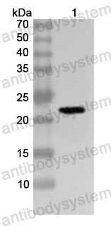 Anti-Human MMP24 Polyclonal Antibody