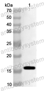 Anti-Human CD369/CLEC7A Polyclonal Antibody