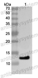 Anti-Human RNF168 Polyclonal Antibody