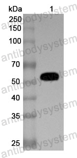 Anti-EIF2AK3 Polyclonal Antibody