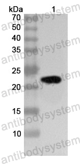 Anti-Human ERVW-1/HERV-W-Env Polyclonal Antibody
