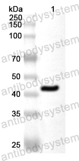 Anti-Human SCARB1/SR-BI/CLA-1/SRB1 Polyclonal Antibody