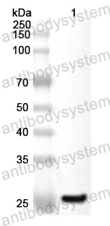 Anti-Human VSIG4/CRIg Polyclonal Antibody