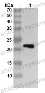Anti-Human PTP4A1/PRL1 Polyclonal Antibody