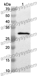Anti-Human IFT57 Polyclonal Antibody