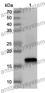 Anti-Human TEX14 Polyclonal Antibody