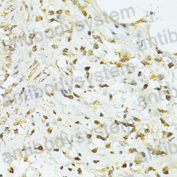 Immunohistochemical for Anti-Human TRIM15 Polyclonal Antibody ?>