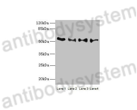 Western Blot for Anti-Human TRIM15 Polyclonal Antibody ?>