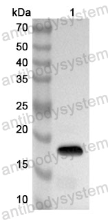 Anti-Human MAP1LC3C Polyclonal Antibody
