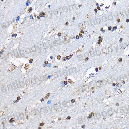Immunohistochemical for Anti-Human EGLN1 Polyclonal Antibody ?>