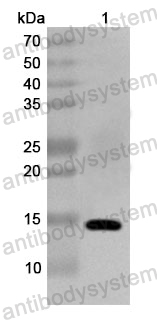 Anti-Human ZNF410 Polyclonal Antibody