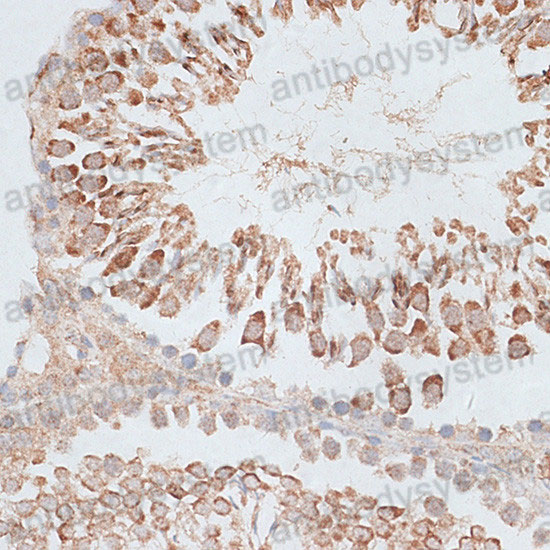 Immunohistochemical for Anti-Human KIF2C Polyclonal Antibody ?>