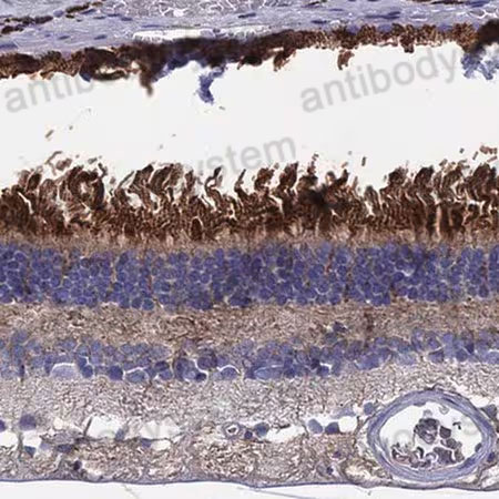Immunohistochemical for Anti-Human BCO2 Polyclonal Antibody ?>