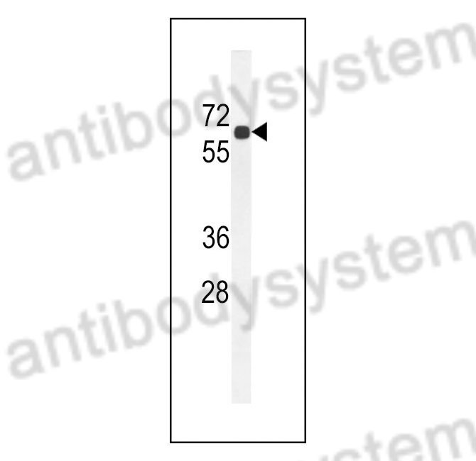 Western Blot for Anti-Human BCO2 Polyclonal Antibody ?>