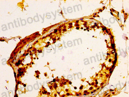 Immunohistochemical for Anti-Human ULBP1 Polyclonal Antibody ?>