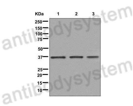 Western Blot for Anti-Human ULBP1 Polyclonal Antibody ?>