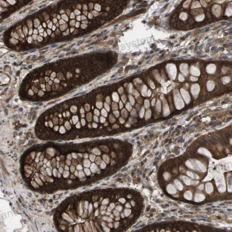 Immunohistochemical for Anti-Human CTPS2 Polyclonal Antibody ?>