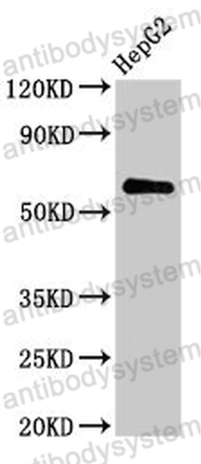 Western Blot for Anti-Human CTPS2 Polyclonal Antibody ?>