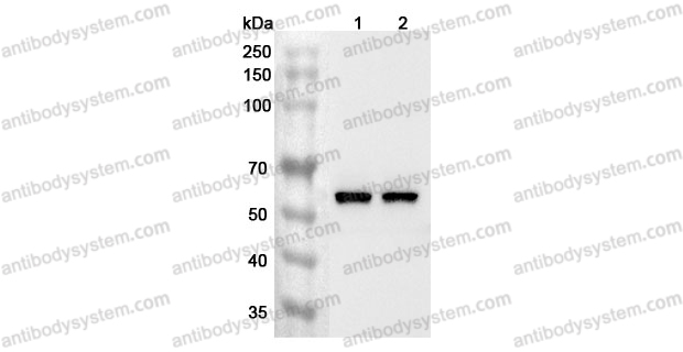 Anti-Human DMAP1 Polyclonal Antibody
