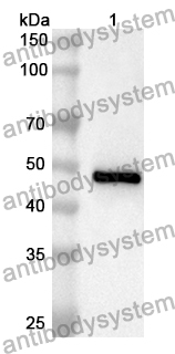Anti-Human SUPT16H Polyclonal Antibody
