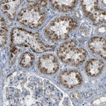 Immunohistochemical for Anti-Human ACBD5 Polyclonal Antibody ?>