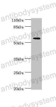 Western Blot for Anti-Human ACBD5 Polyclonal Antibody ?>