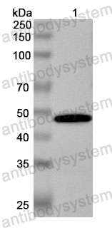 Anti-Human LRRC4 Polyclonal Antibody