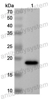 Anti-Human MBIP Polyclonal Antibody