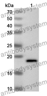 Anti-Human VPS8 Polyclonal Antibody