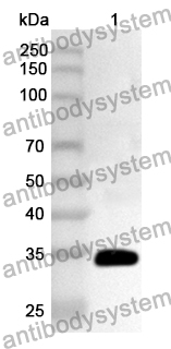 Anti-Human CNOT7 Polyclonal Antibody