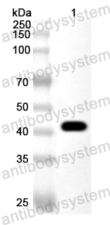 Anti-Human KIAA0895L Polyclonal Antibody