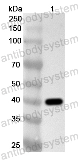 Anti-Human CATSPERB Polyclonal Antibody