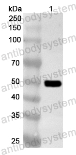 Anti-Human TRABD2A Polyclonal Antibody