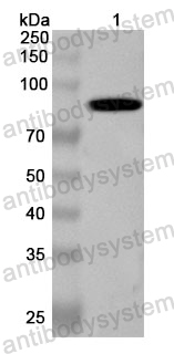 Anti-Human SUPV3L1 Polyclonal Antibody
