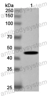 Anti-Human TTL Polyclonal Antibody