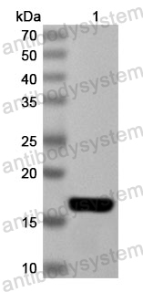 Anti-Human UBAP1 Polyclonal Antibody