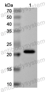 Anti-Human SUN5 Polyclonal Antibody