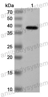 Anti-Human MARK4 Polyclonal Antibody
