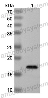 Anti-Human FAF2 Polyclonal Antibody