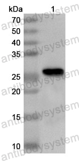 Anti-Human LRATD2 Polyclonal Antibody