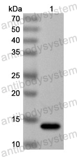 Anti-Human USP37 Polyclonal Antibody
