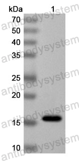 Anti-Human WWP1 Polyclonal Antibody