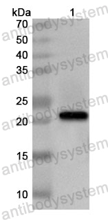 Anti-Human FOXO6 Polyclonal Antibody