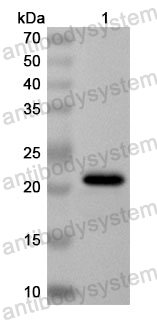 Anti-Human TSPYL2 Polyclonal Antibody