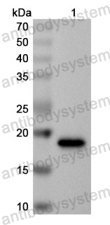 Anti-Human PPARGC1B Polyclonal Antibody
